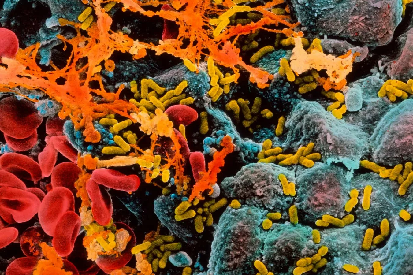 Cystitis or tooth decay could trigger dementia just a few years later