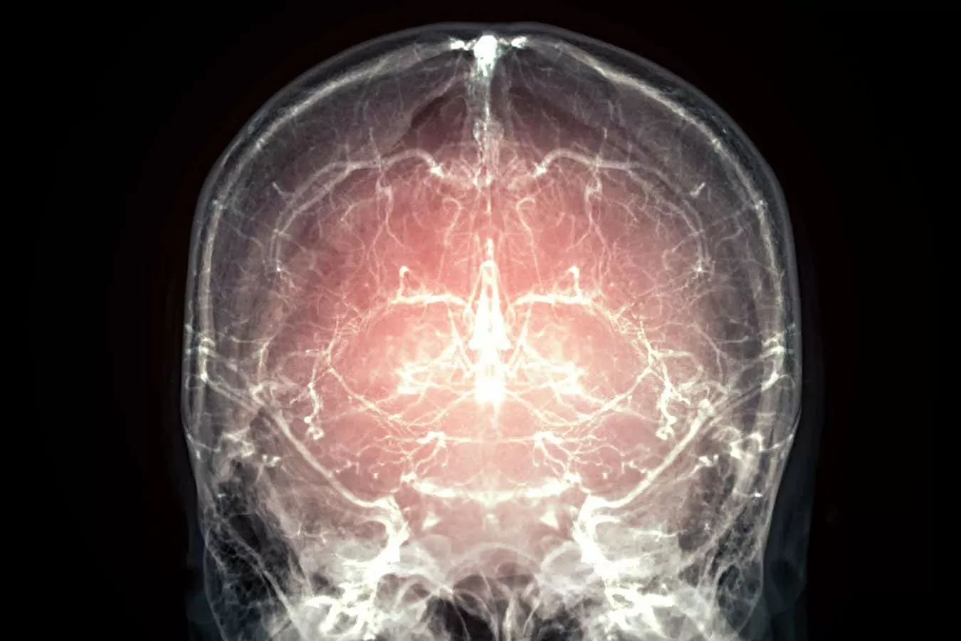 Major leap towards reanimation after death as mammal's brain preserved